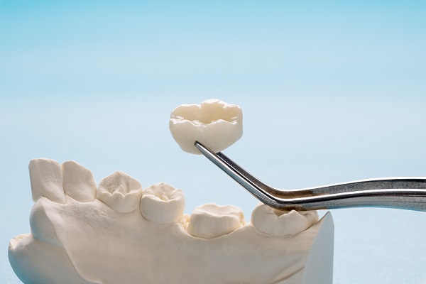 Tips For Taking Care Of Your Dental Crowns